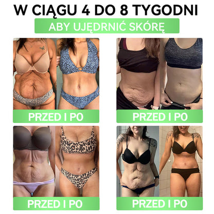 💐💐𝑨𝑵𝑮𝑬𝑳𝑻𝑹𝑨𝑷® Moringa × Berberyna × AMPK 10-w-1 Wsparcie metaboliczne, plaster z nanotechnologią mikroigłową 🇵🇱(Wystarczy raz dziennie, widoczne efekty w 7 dni) ✅ Na otyłość, wiotką skórę, bezdech senny, problemy ze stawami i wiele innych