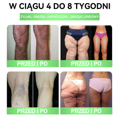 💐💐𝑨𝑵𝑮𝑬𝑳𝑻𝑹𝑨𝑷® Moringa × Berberyna × AMPK 10-w-1 Wsparcie metaboliczne, plaster z nanotechnologią mikroigłową 🇵🇱(Wystarczy raz dziennie, widoczne efekty w 7 dni) ✅ Na otyłość, wiotką skórę, bezdech senny, problemy ze stawami i wiele innych