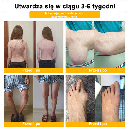 ⏰⏰XRLXRL® Krem Przeciwbólowy z Jadem Pszczelim i Leczeniem Kości (Specjalnie dla osób starszych)