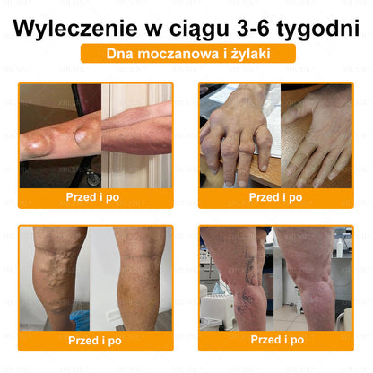 ⏰⏰XRLXRL® Krem Przeciwbólowy z Jadem Pszczelim i Leczeniem Kości (Specjalnie dla osób starszych)