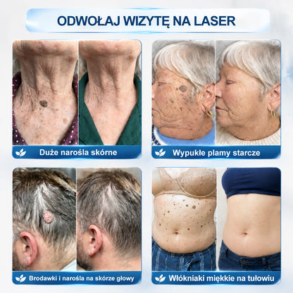Oficjalny sklep markowy |💚Hiskin® 7 𝑫𝒏𝒊 𝑷𝒓𝒆𝒑𝒂𝒓𝒂𝒕 𝑫𝒐 𝑼𝒔𝒖𝒘𝒂𝒏𝒊𝒂 𝑾łó𝒌𝒏𝒊𝒂𝒌ó𝒘 𝑴𝒊ę𝒌𝒌𝒊𝒄𝒉 𝑰 𝑷𝒓𝒛𝒆𝒃𝒂𝒓𝒘𝒊𝒆ń(𝐁𝐞𝐳 𝐁ó𝐥𝐮, 𝐁𝐞𝐳 𝐁𝐥𝐢𝐳𝐧 – 𝐑𝐨𝐥𝐥-𝐨𝐧)