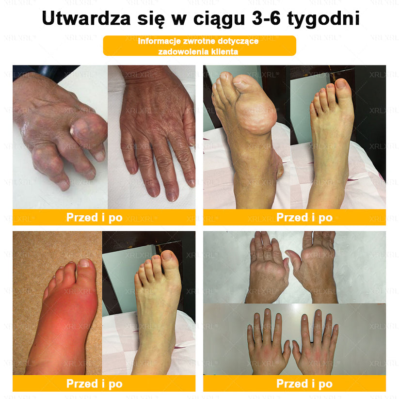 ⏰⏰XRLXRL® Krem Przeciwbólowy z Jadem Pszczelim i Leczeniem Kości (Specjalnie dla osób starszych)