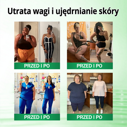 💐💐𝑨𝑵𝑮𝑬𝑳𝑻𝑹𝑨𝑷® Moringa × Berberyna × AMPK 10-w-1 Wsparcie metaboliczne, plaster z nanotechnologią mikroigłową 🇵🇱(Wystarczy raz dziennie, widoczne efekty w 7 dni) ✅ Na otyłość, wiotką skórę, bezdech senny, problemy ze stawami i wiele innych