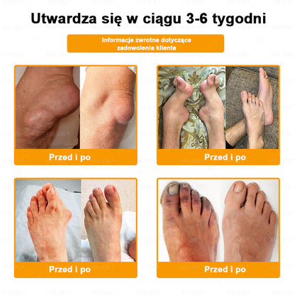 ⏰⏰XRLXRL® Krem Przeciwbólowy z Jadem Pszczelim i Leczeniem Kości (Specjalnie dla osób starszych)